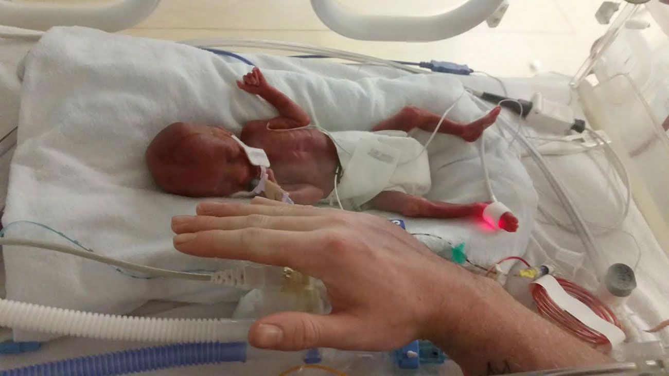 Miracle Baby Born One Week Before Abortion Limit Survives - Celebrities ...