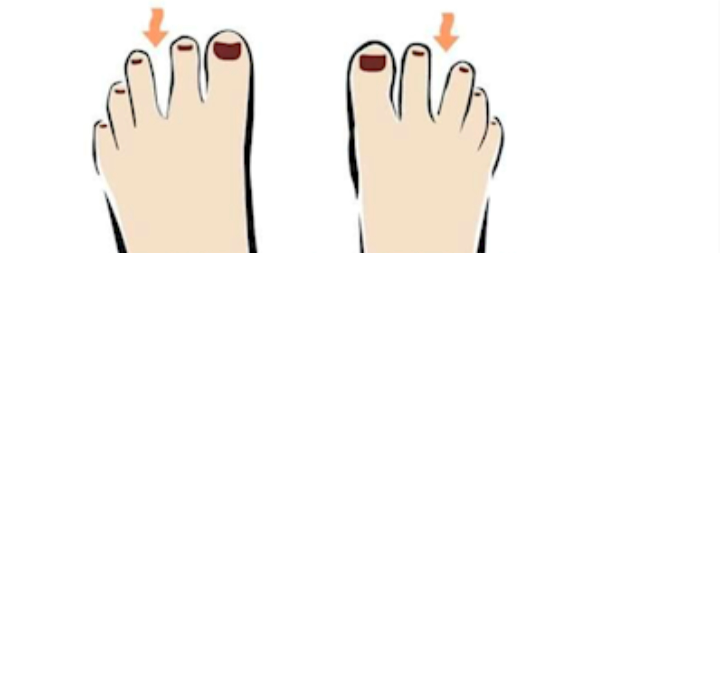 10 Kind Of Feet And What They Say About You- PICS - Science/Technology ...