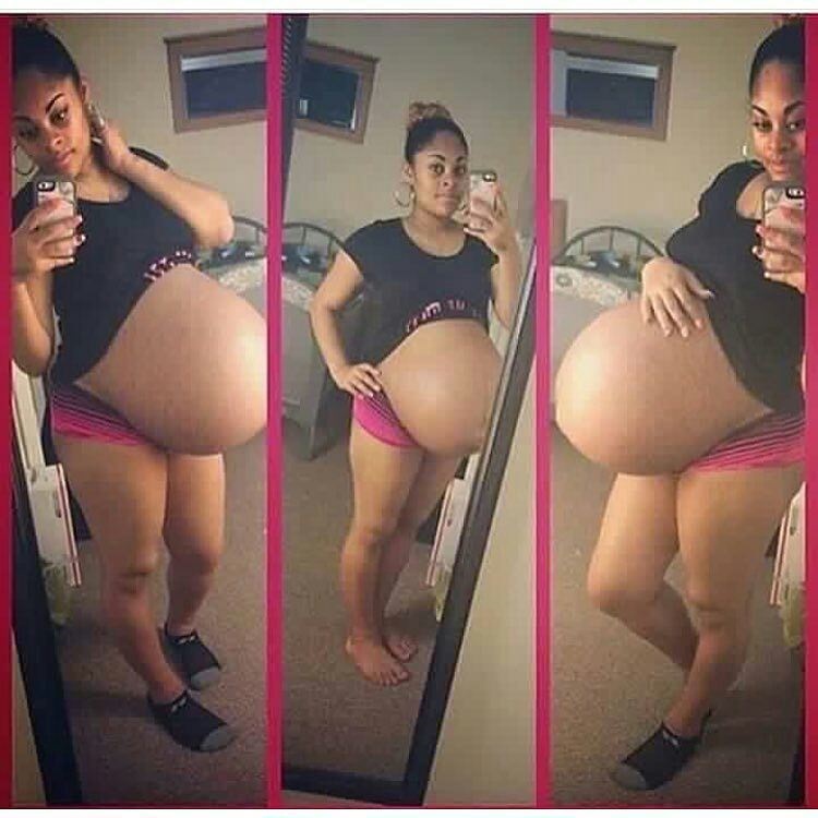 See This Pregnant Woman, Is This Normal? 