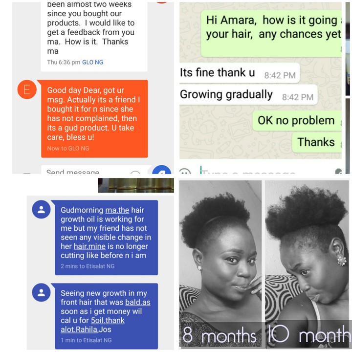 Extreme Hair Growth With Customers Reviews - NYSC - Nigeria