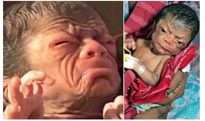 Meet The Newborn Baby Who Looks Like An 80-year-old Man ...
