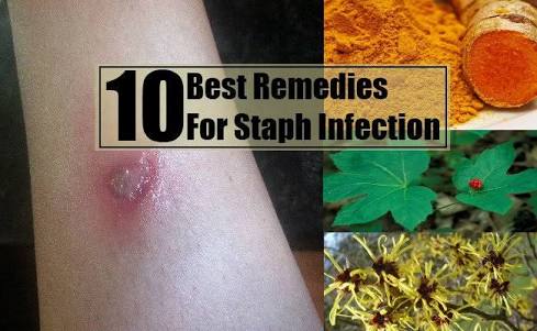 does septra treat staph infection