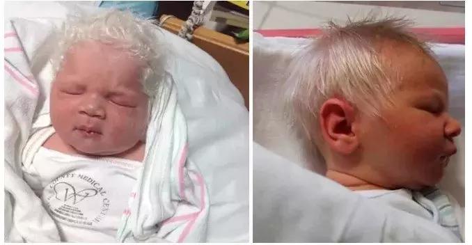Meet Newborn Who Was Born With Grey Hair And He Is Adorable (photos) -  Education - Nigeria