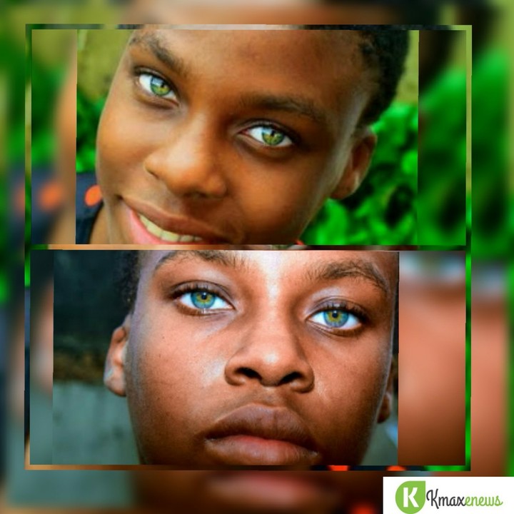 The Nigerian girl with the golden eyesis this normal or a
