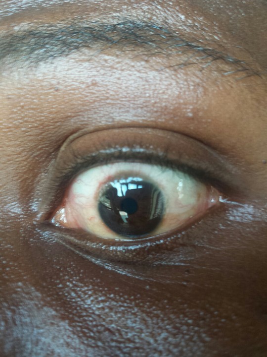 Ask The Eye Doctor Any Problem Concerning The Eyes - Health (38) - Nigeria