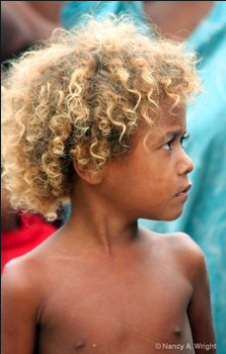 Black People With Natural Blonde Hair In Solomon Islands Photos