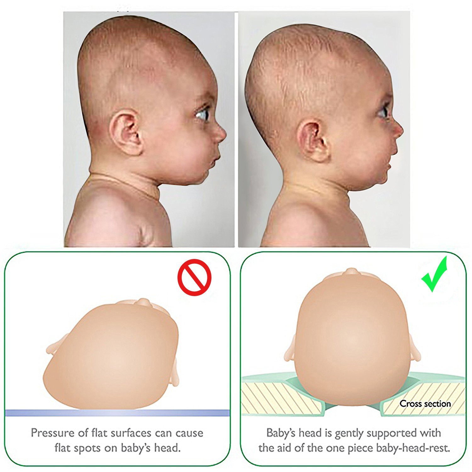 Затылок новорожденного. Форма головы новорожденного. Правильная форма головы у грудничка.