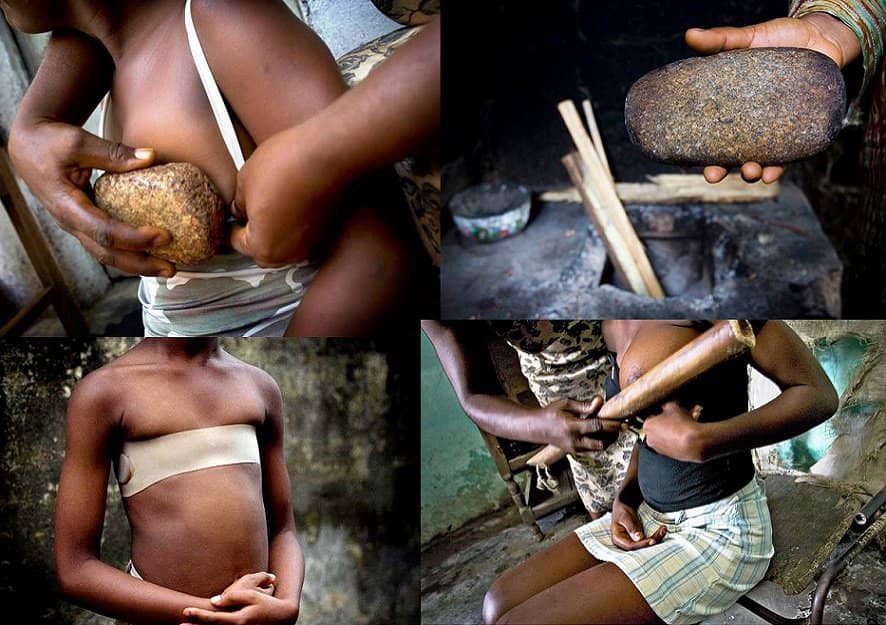 Discussing An Under-reported Torture To Girls – Breast Ironing - Crime - Nigeria