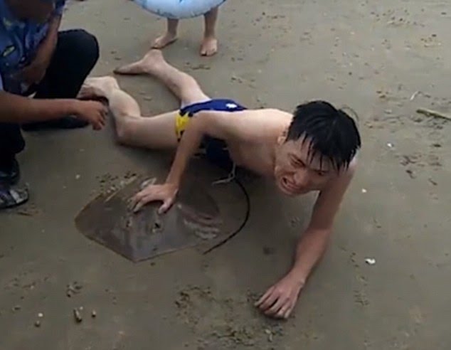 Chinese Man Gets Stung In His Dick By Stingray While Swimming (Pics) -  Health - Nigeria