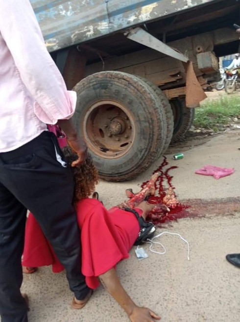 Lady's Leg Got Crushed By Truck On Her Way To Work (graphic Photos) -  Celebrities - Nigeria