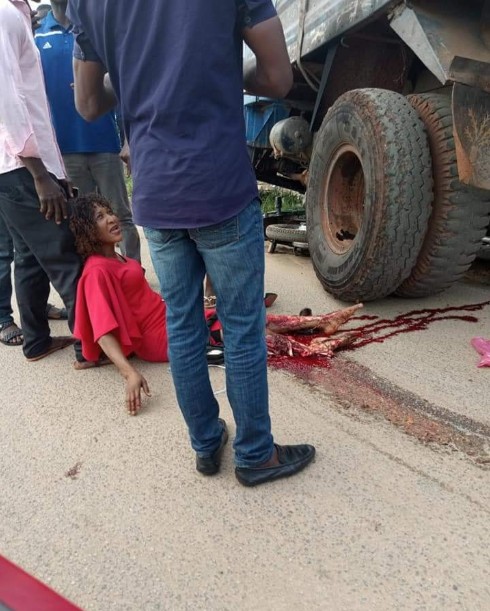 Lady's Leg Got Crushed By Truck On Her Way To Work (graphic Photos) -  Celebrities - Nigeria