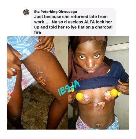 Alfa Burns A Girl's Chest With Hot Charcoal As Punishment (Graphic Photos)  - Crime - Nigeria