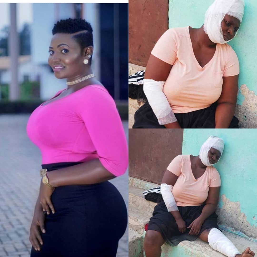 Big Booty Actress Safina Haroun Involved In A Car Accident [PICS] -  Celebrities - Nigeria