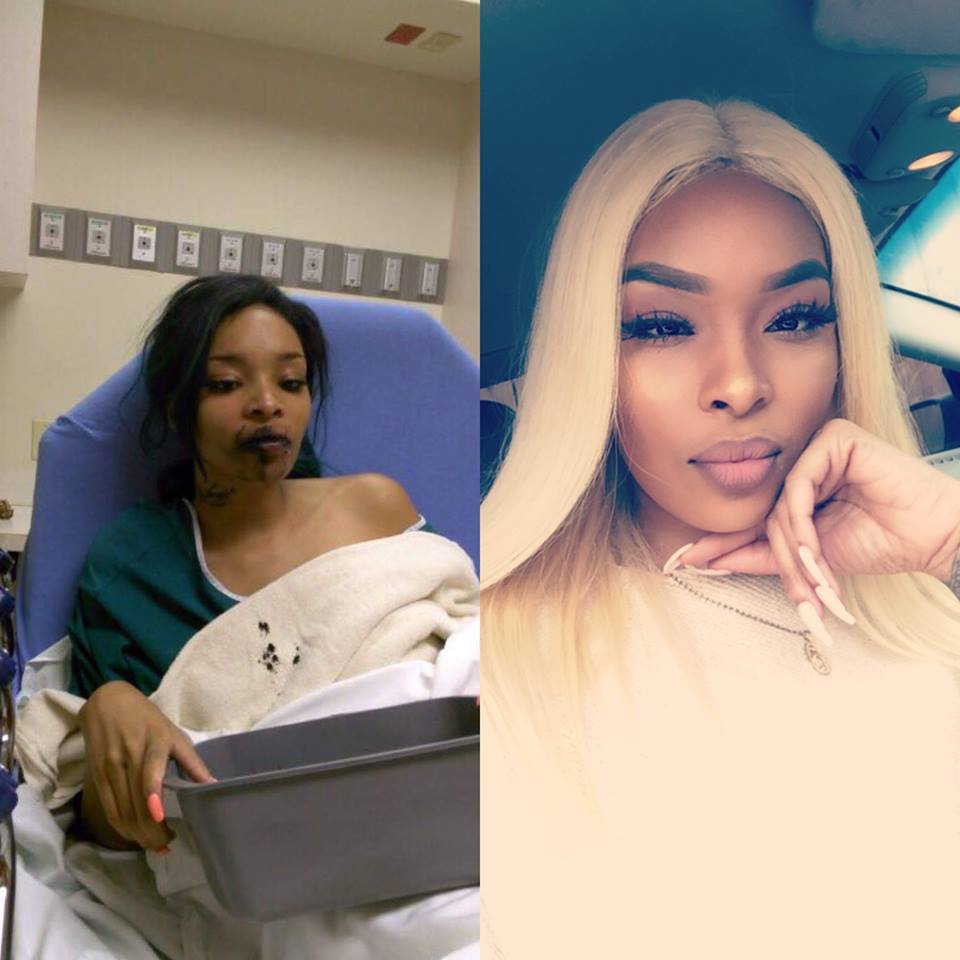Lady Shares Transformation Photo After Almost Committing Suicide Over Depre...