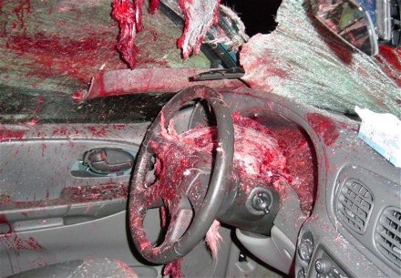 Nasty effects of road accidents (caution very graphic and ...